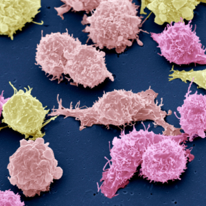Cancer-cells-SEM-by-Steve-Gschmeissnes-from-Science-Photo-Library-via-Canva_dot_com